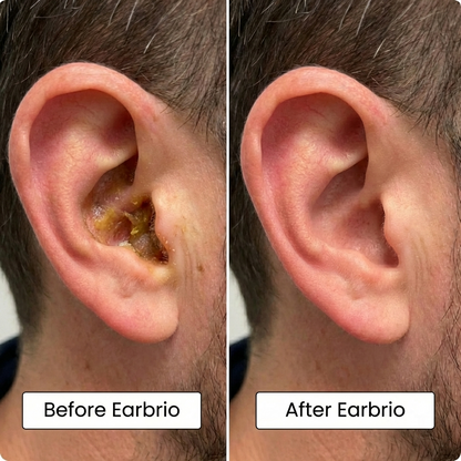 Earbrio ProClean